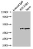 Immunoprecipitating SULT2B1 in MCF-7 whole cell lysate<br />
 Lane 1: Rabbit control IgG instead of (1µg) instead of CSB-PA022943ESR2HU in MCF-7 whole cell lysate.
 For western blotting, a HRP-conjugated anti-rabbit IgG, specific to the non-reduced form of IgG was used as the Secondary antibody (1/50000) <br />
 Lane 2: CSB-PA022943ESR2HU (4µg) + MCF-7 whole cell lysate (500µg) <br />
 Lane 3: MCF-7 whole cell lysate (20µg) <br />