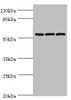 Western blot<br />
 All lanes: Alpha-amylase 2B antibody at 8µg/ml<br />
 Lane 1: Mouse skeletal muscle tissue<br />
 Lane 2: HL60 whole cell lysate<br />
 Lane 3: K562 whole cell lysate<br />
 Secondary<br />
 Goat polyclonal to rabbit IgG at 1/10000 dilution<br />
 Predicted band size: 58, 43 kDa<br />
 Observed band size: 58 kDa<br />