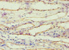 Immunohistochemistry of paraffin-embedded human kidney tissue using CSB-PA001540ESR2HU at dilution of 1:100