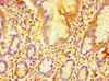 Immunohistochemistry of paraffin-embedded human small intestine tissue using CSB-PA859414ESR2HU at dilution of 1:100