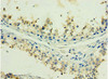Immunohistochemistry of paraffin-embedded human testis tissue using CSB-PA010097DSR1HU at dilution of 1:100