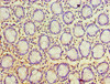 Immunohistochemistry of paraffin-embedded human colon tissue using CSB-PA018840ESR2HU at dilution of 1:100