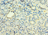 Immunohistochemistry of paraffin-embedded human pancreatic tissue using CSB-PA801263ESR2HU at dilution of 1:100