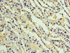 Immunohistochemistry of paraffin-embedded human lung tissue using CSB-PA892152ESR1HU at dilution of 1:100