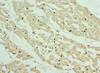 Immunohistochemistry of paraffin-embedded human heart tissue using CSB-PA892350ESR2HU at dilution of 1:100