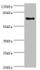 Western blot<br />
 All lanes: SLC27A6 antibody at 4µg/ml + MCF-7 whole cell lysate<br />
 Secondary<br />
 Goat polyclonal to rabbit IgG at 1/10000 dilution<br />
 Predicted band size: 70 kDa<br />
 Observed band size: 70 kDa<br />