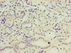 Immunohistochemistry of paraffin-embedded human pancreatic tissue using CSB-PA021097ESR2HU at dilution of 1:100