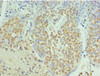 Immunohistochemistry of paraffin-embedded human tonsil tissue using CSB-PA623902ESR1HU at dilution of 1:100