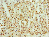 Immunohistochemistry of paraffin-embedded human adrenal gland tissue using CSB-PA880941ESR2HU at dilution of 1:100