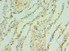 Immunohistochemistry of paraffin-embedded human lung tissue using CSB-PA024050ESR1HU at dilution of 1:100
