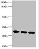 Western blot<br />
 All lanes: PRKAB2 antibody at 5µg/ml<br />
 Lane 1: Rat brain tissue<br />
 Lane 2: Mouse heart tissue<br />
 Lane 3: Mouse gonad tissue<br />
 Secondary<br />
 Goat polyclonal to rabbit IgG at 1/10000 dilution<br />
 Predicted band size: 31, 22 kDa<br />
 Observed band size: 31 kDa<br />