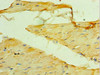 Immunohistochemistry of paraffin-embedded human skeletal muscle tissue using CSB-PA015364DSR2HU at dilution of 1:100