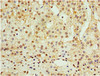 Immunohistochemistry of paraffin-embedded human adrenal gland tissue using CSB-PA001322DSR1HU at dilution of 1:100