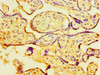 Immunohistochemistry of paraffin-embedded human placenta tissue using CSB-PA842625ESR2HU at dilution of 1:100