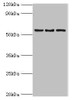 Western blot<br />
 All lanes: ARFGAP3 antibody at 4µg/ml<br />
 Lane 1: HepG2 whole cell lysate<br />
 Lane 2: Jurkat whole cell lysate<br />
 Lane 3: A549 whole cell lysate<br />
 Secondary<br />
 Goat polyclonal to rabbit IgG at 1/10000 dilution<br />
 Predicted band size: 57, 52 kDa<br />
 Observed band size: 57 kDa<br />