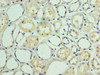 Immunohistochemistry of paraffin-embedded human kidney tissue using CSB-PA342402ESR2HU at dilution of 1:100