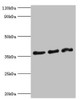 Western blot<br />
 All lanes: DFFA antibody at 10µg/ml<br />
 Lane 1: Hela whole cell lysate<br />
 Lane 2: 293T whole cell lysate<br />
 Lane 3: PC-3 whole cell lysate<br />
 Secondary<br />
 Goat polyclonal to rabbit IgG at 1/10000 dilution<br />
 Predicted band size: 37, 30 kDa<br />
 Observed band size: 37 kDa<br />