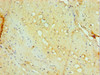 Immunohistochemistry of paraffin-embedded human small intestine tissue using CSB-PA878935ESR2HU at dilution of 1:100