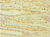 Immunohistochemistry of paraffin-embedded human kidney tissue using CSB-PA002369ESR1HU at dilution of 1:100