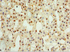 Immunohistochemistry of paraffin-embedded human adrenal gland tissue using CSB-PA004435ESR1HU at dilution of 1:100