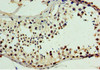 Immunohistochemistry of paraffin-embedded human testis tissue using CSB-PA005327ESR1HU at dilution of 1:100
