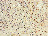 Immunohistochemistry of paraffin-embedded human adrenal gland tissue using CSB-PA623015ESR2HU at dilution of 1:100