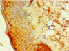 Immunohistochemistry of paraffin-embedded human skin tissue using CSB-PA006705ESR1HU at dilution of 1:100