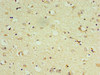 Immunohistochemistry of paraffin-embedded human brain tissue using CSB-PA007180ESR1HU at dilution of 1:100