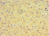 Immunohistochemistry of paraffin-embedded human liver tissue using CSB-PA006004DSR1HU at dilution of 1:100