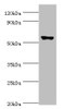 Western blot<br />
 All lanes: CLK2 antibody at 5µg/ml + Hela whole cell lysate<br />
 Secondary<br />
 Goat polyclonal to rabbit IgG at 1/10000 dilution<br />
 Predicted band size: 61, 18, 60 kDa<br />
 Observed band size: 61 kDa<br />