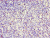 Immunohistochemistry of paraffin-embedded human thymus tissue using CSB-PA005558ESR2HU at dilution of 1:100