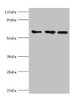 Western blot<br />
 All lanes: ABCE1 antibody at 4µg/ml<br />
 Lane 1: 293T whole cell lysate<br />
 Lane 2: Hela whole cell lysate<br />
 Lane 3: k562 whole cell lysate<br />
 Secondary<br />
 Goat polyclonal to rabbit IgG at 1/10000 dilution<br />
 Predicted band size: 67 kDa<br />
 Observed band size: 67 kDa<br />