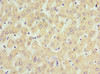 Immunohistochemistry of paraffin-embedded human liver tissue using CSB-PA858415ESR2HU at dilution of 1:100