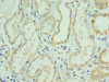 Immunohistochemistry of paraffin-embedded human kidney tissue using CSB-PA621669DSR1HU at dilution of 1:100