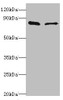 Western blot<br />
 All lanes: SLC39A6 antibody at 10µg/ml<br />
 Lane 1: Hela whole cell lysate<br />
 Lane 2: 293T whole cell lysate<br />
 Secondary<br />
 Goat polyclonal to rabbit IgG at 1/10000 dilution<br />
 Predicted band size: 86, 49 kDa<br />
 Observed band size: 86 kDa<br />