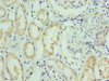 Immunohistochemistry of paraffin-embedded human kidney tissue using CSB-PA621669DSR2HU at dilution of 1:100