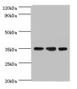 Western blot<br />
 All lanes: AIMP2 antibody at 5µg/ml<br />
 Lane 1: Hela whole cell lysate<br />
 Lane 2: HepG2 whole cell lysate<br />
 Lane 3: K562 whole cell lysate<br />
 Secondary<br />
 Goat polyclonal to rabbit IgG at 1/10000 dilution<br />
 Predicted band size: 35 kDa<br />
 Observed band size: 35 kDa<br />