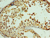 Immunohistochemistry of paraffin-embedded human testis tissue using CSB-PA818781DSR1HU at dilution of 1:100