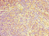 Immunohistochemistry of paraffin-embedded human tonsil tissue using CSB-PA620893ESR2HU at dilution of 1:100