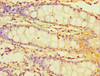 Immunohistochemistry of paraffin-embedded human colon tissue using CSB-PA620893ESR2HU at dilution of 1:100