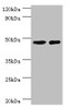 Western blot<br />
 All lanes: SMAD3 antibody at 8µg/ml<br />
 Lane 1: Jurkat whole cell lysate<br />
 Lane 2: A431 whole cell lysate<br />
 Secondary<br />
 Goat polyclonal to rabbit IgG at 1/10000 dilution<br />
 Predicted band size: 49, 44, 36, 26 kDa<br />
 Observed band size: 49 kDa<br />