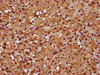 IHC image of CSB-PA021788ESR2HU diluted at 1:388 and staining in paraffin-embedded human adrenal gland tissue performed on a Leica BondTM system. After dewaxing and hydration, antigen retrieval was mediated by high pressure in a citrate buffer (pH 6.0) . Section was blocked with 10% normal goat serum 30min at RT. Then primary antibody (1% BSA) was incubated at 4°C overnight. The primary is detected by a biotinylated secondary antibody and visualized using an HRP conjugated SP system.