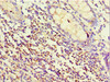 Immunohistochemistry of paraffin-embedded human colon tissue using CSB-PA022880DSR1HU at dilution of 1:100