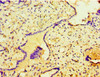 Immunohistochemistry of paraffin-embedded human placenta tissue using CSB-PA022880DSR2HU at dilution of 1:100
