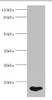 Western blot<br />
 All lanes: FABP5 antibody at 5µg/ml + HepG2 whole cell lysate<br />
 Secondary<br />
 Goat polyclonal to rabbit IgG at 1/10000 dilution<br />
 Predicted band size: 15 kDa<br />
 Observed band size: 15 kDa<br />