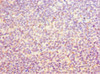 Immunohistochemistry of paraffin-embedded human tonsil tissue using CSB-PA893418ESR2HU at dilution of 1:100