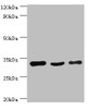 Western blot<br />
 All lanes: PHB2 antibody at 3µg/ml<br />
 Lane 1: Hela whole cell lysate<br />
 Lane 2: K562 whole cell lysate<br />
 Lane 3: MCF-7 whole cell lysate<br />
 Secondary<br />
 Goat polyclonal to rabbit IgG at 1/10000 dilution<br />
 Predicted band size: 34, 30 kDa<br />
 Observed band size: 34 kDa<br />