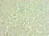 Immunohistochemistry of paraffin-embedded human liver tissue using CSB-PA889097ESR1HU at dilution of 1:100