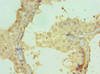 Immunohistochemistry of paraffin-embedded human testis tissue using CSB-PA005975ESR1HU at dilution of 1:100