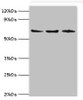 Western blot<br />
 All lanes: ACAD9 antibody at 6µg/ml<br />
 Lane 1: MCF-7 whole cell lysate<br />
 Lane 2: 293T whole cell lysate<br />
 Lane 3: K562 whole cell lysate<br />
 Secondary<br />
 Goat polyclonal to rabbit IgG at 1/10000 dilution<br />
 Predicted band size: 69 kDa<br />
 Observed band size: 69 kDa<br />